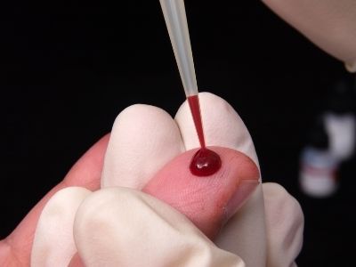 HCM, qué significa en un análisis de sangre