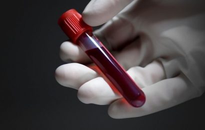 VCM, ¿qué significa en un análisis de sangre?