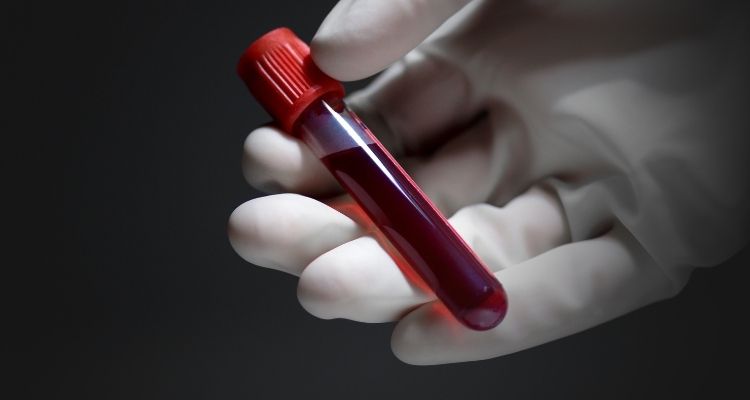 VCM, qué significa en un análisis de sangre