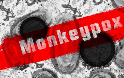La viruela del mono ya está presente en 14 países de América con más de 1300 casos￼